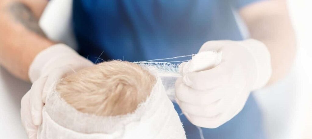 Understanding Head Injuries in Children